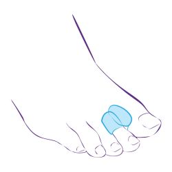 Перегородка межпальцевая на второй палец стопы увеличенного размера СТ-54.3  Trives