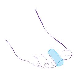 Колпачки силиконовые для защиты пальцев стопы СТ-44  Trives