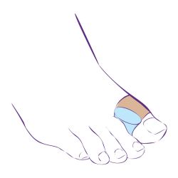 Перегородка межпальцевая на второй палец стопы увеличенного размера СТ-54.4  Trives