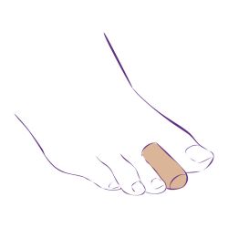 СТ-66 Приспособление корригирующее (тканевый колпачок)