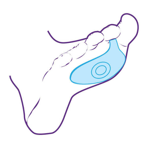 Плюсневая подушечка СТ-33  Trives
